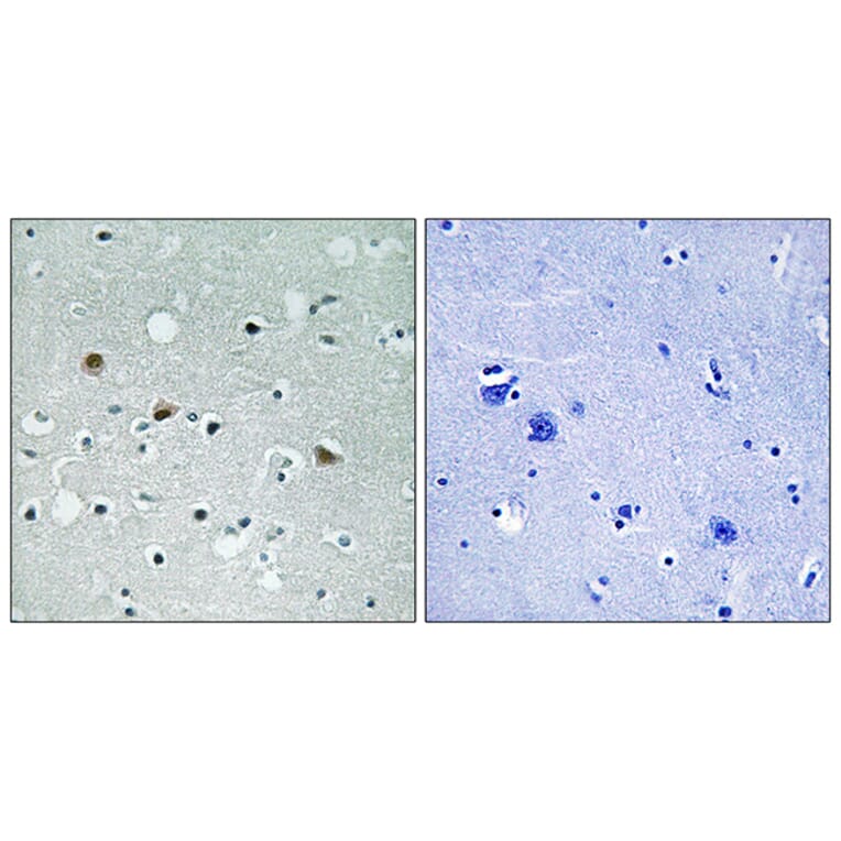 Immunohistochemistry - Anti-LATS1 + LATS2 (phospho Thr1079 + Thr1041) Antibody (A8125) - Antibodies.com