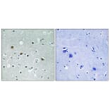 Immunohistochemistry - Anti-LATS1 + LATS2 (phospho Thr1079 + Thr1041) Antibody (A8125) - Antibodies.com