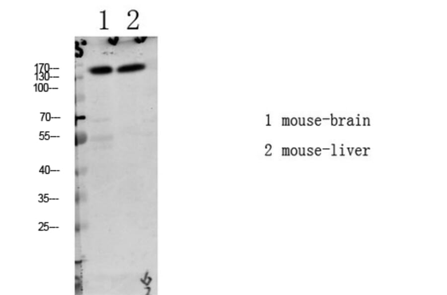 Western Blot - Anti-LATS1 + LATS2 (phospho Thr1079 + Thr1041) Antibody (A8125) - Antibodies.com