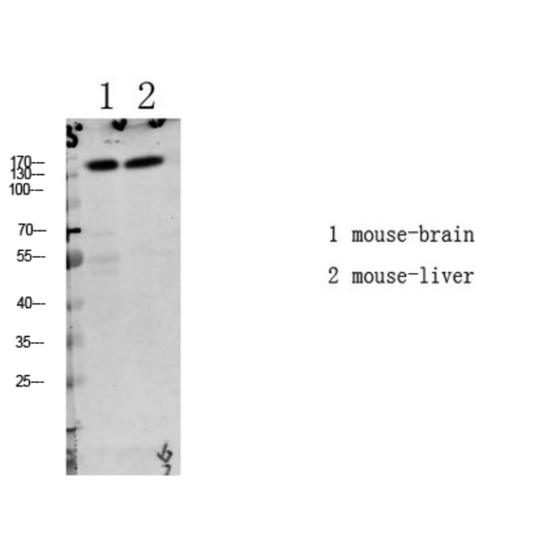 Western Blot - Anti-LATS1 + LATS2 (phospho Thr1079 + Thr1041) Antibody (A8125) - Antibodies.com