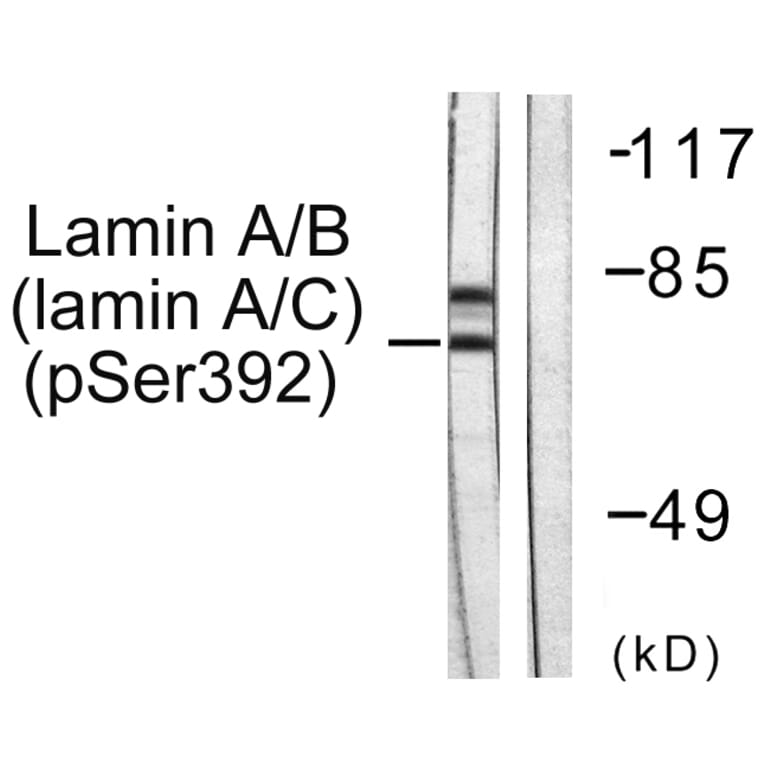 Western Blot - Anti-Lamin A + C (phospho Ser392) Antibody (A0503) - Antibodies.com