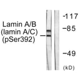 Western Blot - Anti-Lamin A + C (phospho Ser392) Antibody (A0503) - Antibodies.com