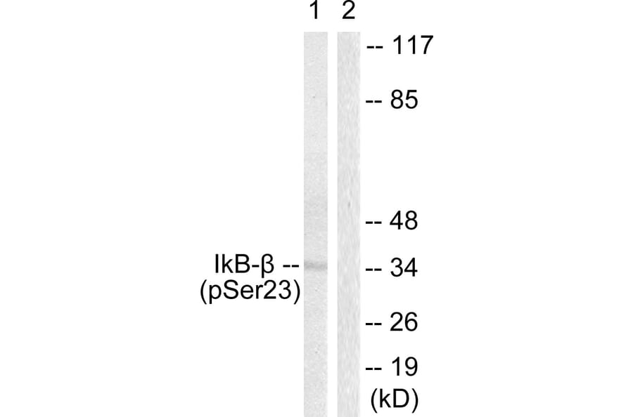 Western Blot - Anti-IkappaB-beta (phospho Ser23) Antibody (A0014) - Antibodies.com