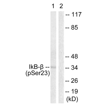 Western Blot - Anti-IkappaB-beta (phospho Ser23) Antibody (A0014) - Antibodies.com