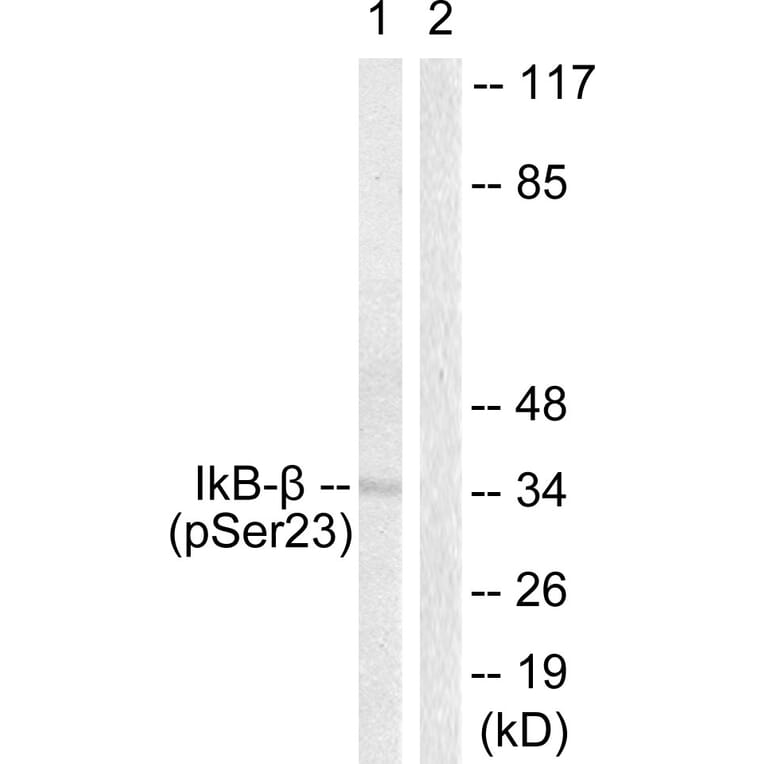 Western Blot - Anti-IkappaB-beta (phospho Ser23) Antibody (A0014) - Antibodies.com