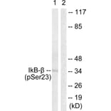 Western Blot - Anti-IkappaB-beta (phospho Ser23) Antibody (A0014) - Antibodies.com