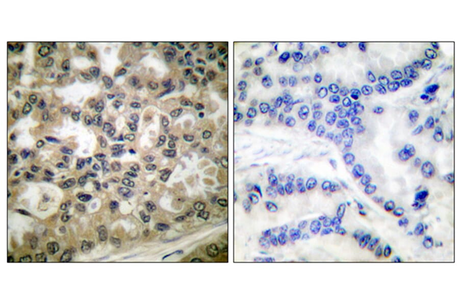 Immunohistochemistry - Anti-IkappaB-beta (phospho Ser23) Antibody (A0014) - Antibodies.com