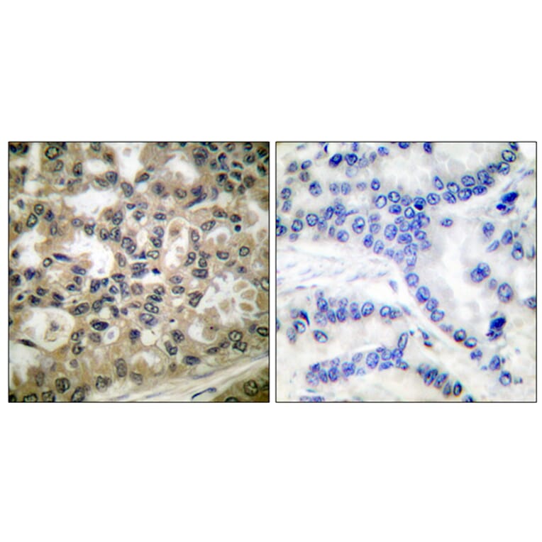 Immunohistochemistry - Anti-IkappaB-beta (phospho Ser23) Antibody (A0014) - Antibodies.com