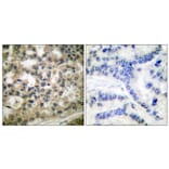 Immunohistochemistry - Anti-IkappaB-beta (phospho Ser23) Antibody (A0014) - Antibodies.com