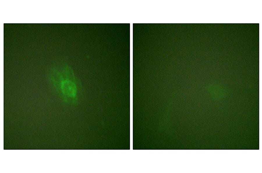 Immunofluorescence - Anti-IkappaB-beta (phospho Ser23) Antibody (A0014) - Antibodies.com