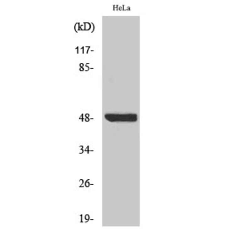 Western Blot - Anti-IkappaB-beta (phospho Ser23) Antibody (A0014) - Antibodies.com