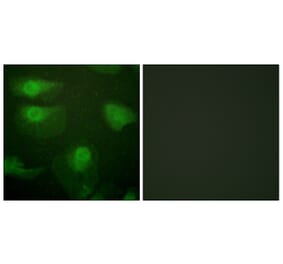 Immunofluorescence - Anti-CaMK1-alpha (phospho Thr177) Antibody (A0830) - Antibodies.com