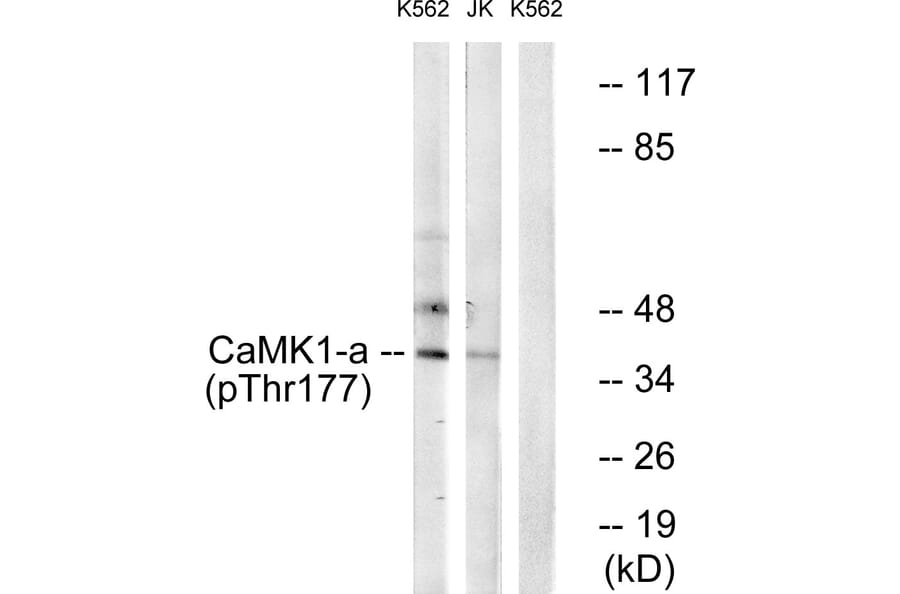 Western Blot - Anti-CaMK1-alpha (phospho Thr177) Antibody (A0830) - Antibodies.com