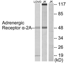 Western Blot - Anti-Adrenergic Receptor alpha-2A Antibody (C10309) - Antibodies.com