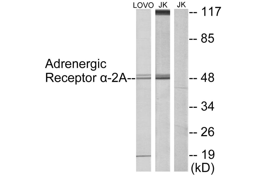 Western Blot - Anti-Adrenergic Receptor alpha-2A Antibody (C10309) - Antibodies.com