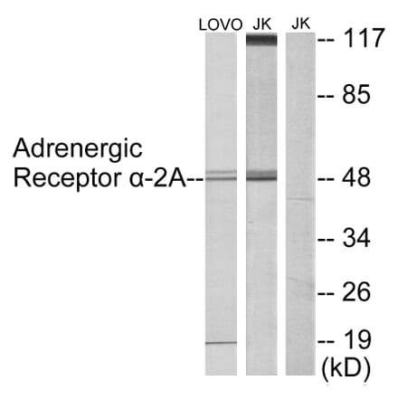Western Blot - Anti-Adrenergic Receptor alpha-2A Antibody (C10309) - Antibodies.com
