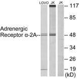 Western Blot - Anti-Adrenergic Receptor alpha-2A Antibody (C10309) - Antibodies.com