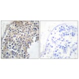 Immunohistochemistry - Anti-Adrenergic Receptor alpha-2A Antibody (C10309) - Antibodies.com