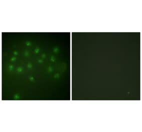 Immunofluorescence - Anti-Vitamin D Receptor (phospho Ser208) Antibody (A1245) - Antibodies.com