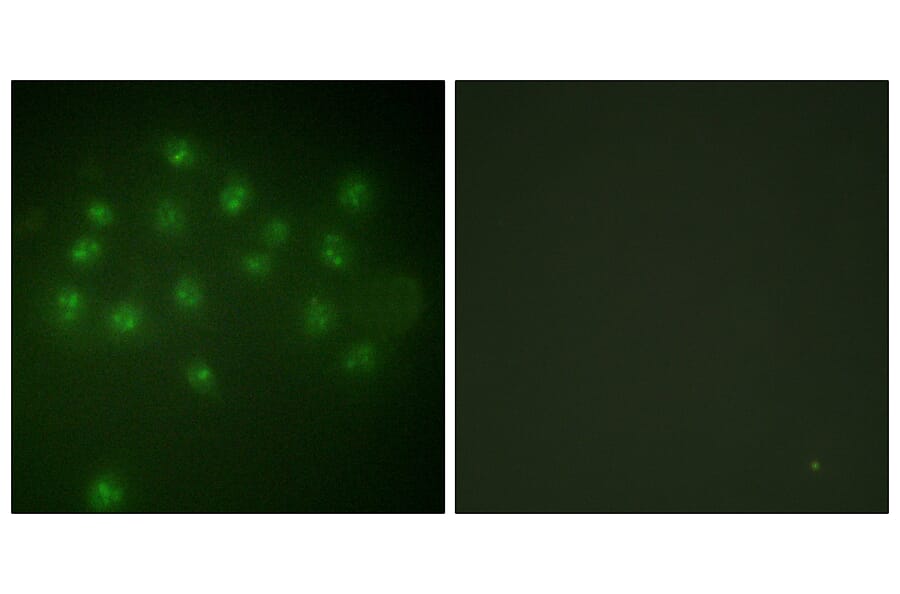 Immunofluorescence - Anti-Vitamin D Receptor (phospho Ser208) Antibody (A1245) - Antibodies.com