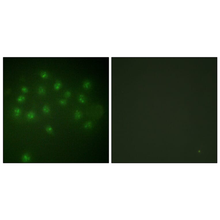 Immunofluorescence - Anti-Vitamin D Receptor (phospho Ser208) Antibody (A1245) - Antibodies.com