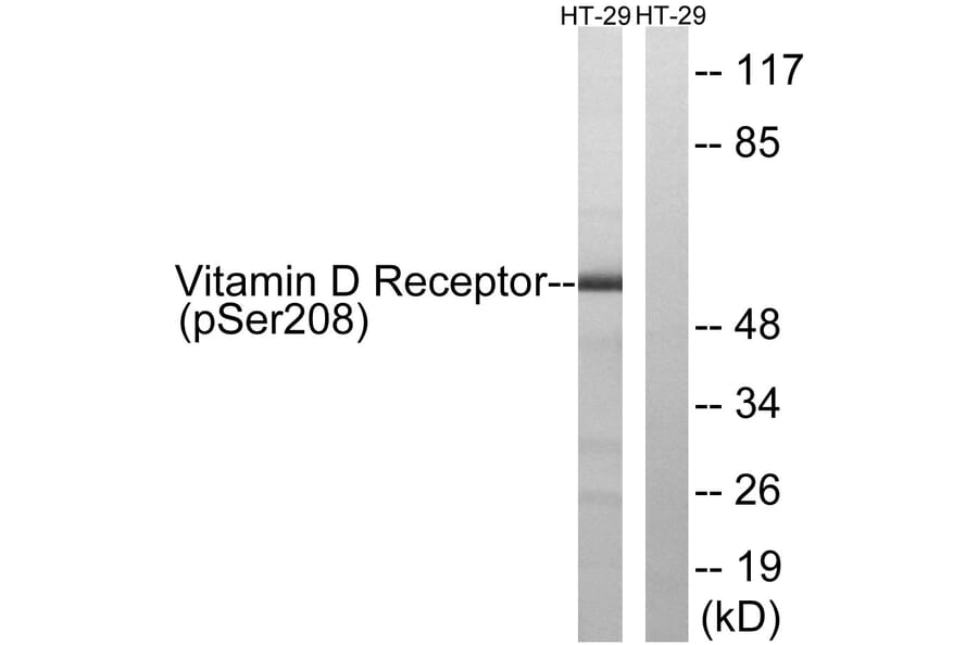 Western Blot - Anti-Vitamin D Receptor (phospho Ser208) Antibody (A1245) - Antibodies.com