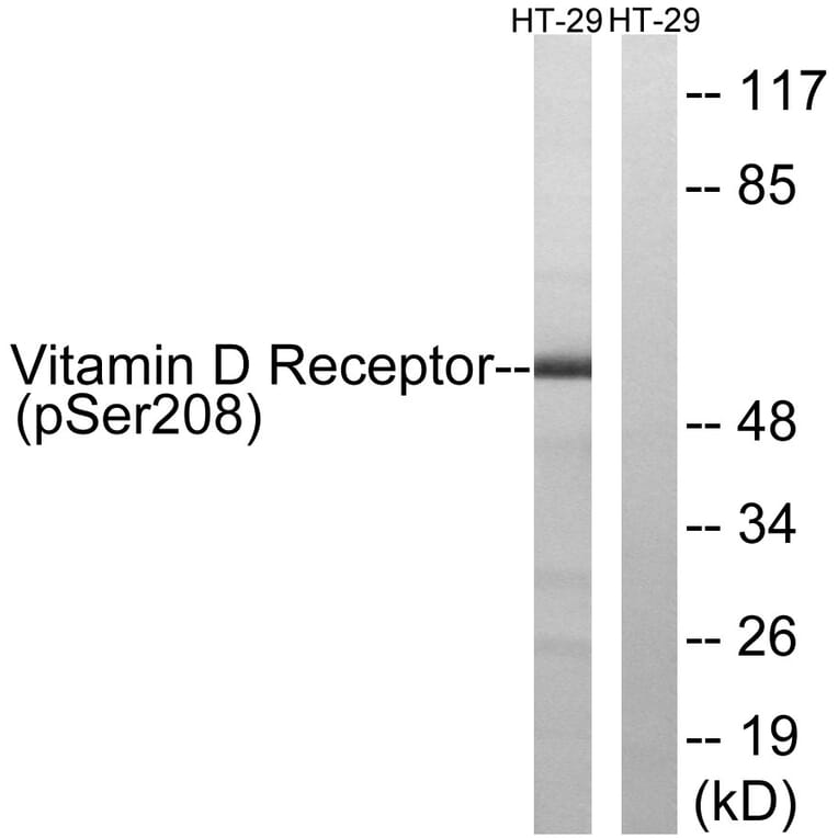 Western Blot - Anti-Vitamin D Receptor (phospho Ser208) Antibody (A1245) - Antibodies.com