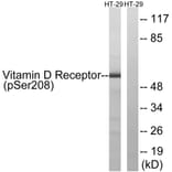 Western Blot - Anti-Vitamin D Receptor (phospho Ser208) Antibody (A1245) - Antibodies.com