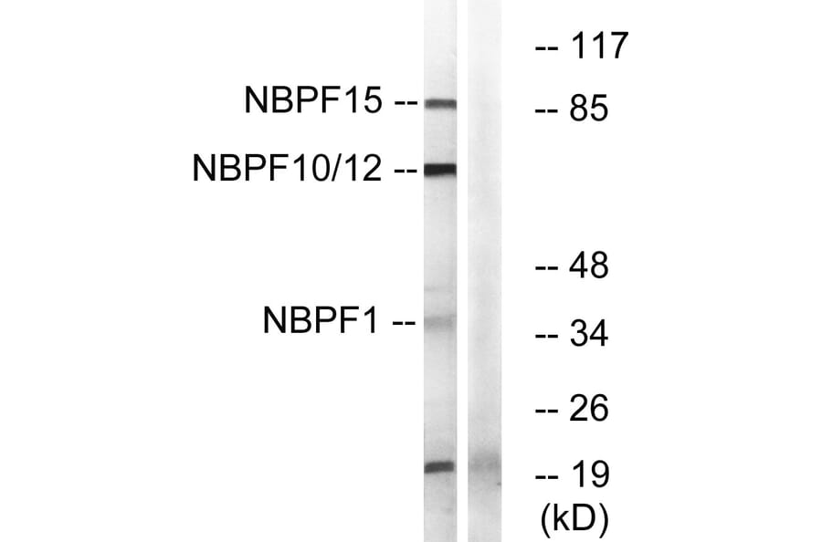Western Blot - Anti-NBPF1 + 9 + 10 + 12 + 14 + 15 + 16 + 20 Antibody (C16925) - Antibodies.com