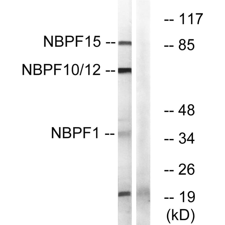 Western Blot - Anti-NBPF1 + 9 + 10 + 12 + 14 + 15 + 16 + 20 Antibody (C16925) - Antibodies.com