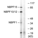 Western Blot - Anti-NBPF1 + 9 + 10 + 12 + 14 + 15 + 16 + 20 Antibody (C16925) - Antibodies.com