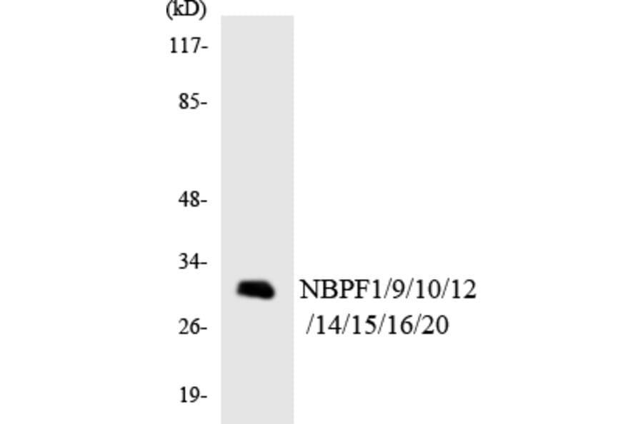 Western Blot - Anti-NBPF1 + 9 + 10 + 12 + 14 + 15 + 16 + 20 Antibody (R12-3076) - Antibodies.com