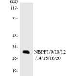 Western Blot - Anti-NBPF1 + 9 + 10 + 12 + 14 + 15 + 16 + 20 Antibody (R12-3076) - Antibodies.com