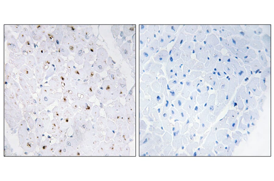 Immunohistochemistry - Anti-Bloom Syndrome (phospho Thr99) Antibody (A0778) - Antibodies.com
