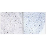 Immunohistochemistry - Anti-Bloom Syndrome (phospho Thr99) Antibody (A0778) - Antibodies.com