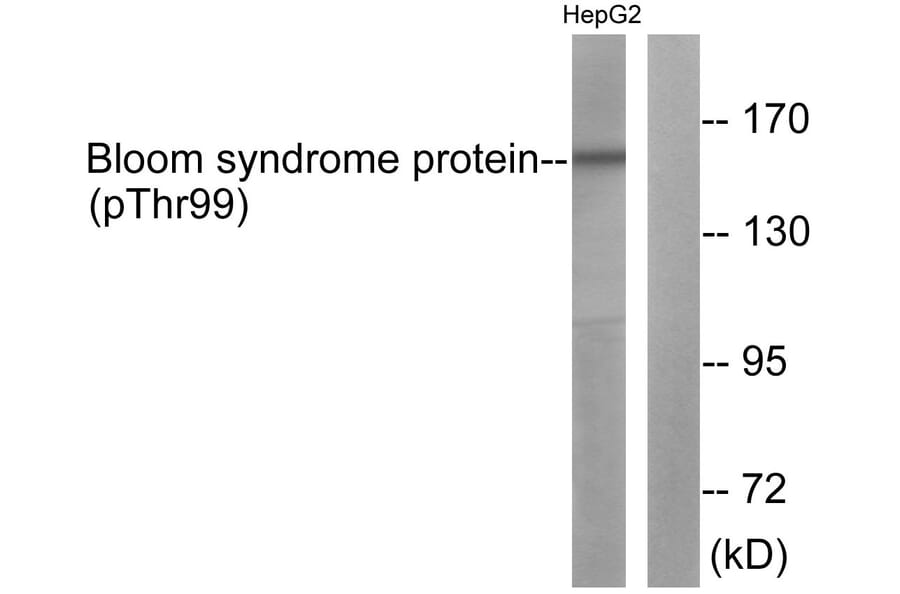 Western Blot - Anti-Bloom Syndrome (phospho Thr99) Antibody (A0778) - Antibodies.com