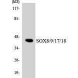 Western Blot - Anti-SOX8 + SOX9 + SOX17 + SOX18 Antibody (R12-3551) - Antibodies.com