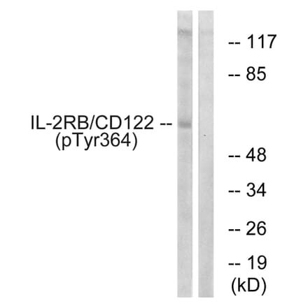 Western Blot - Anti-IL-2R beta (phospho Tyr364) Antibody (A1063) - Antibodies.com