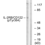 Western Blot - Anti-IL-2R beta (phospho Tyr364) Antibody (A1063) - Antibodies.com