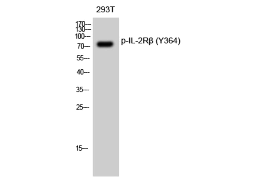 Western Blot - Anti-IL-2R beta (phospho Tyr364) Antibody (A1063) - Antibodies.com