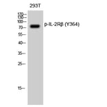 Western Blot - Anti-IL-2R beta (phospho Tyr364) Antibody (A1063) - Antibodies.com