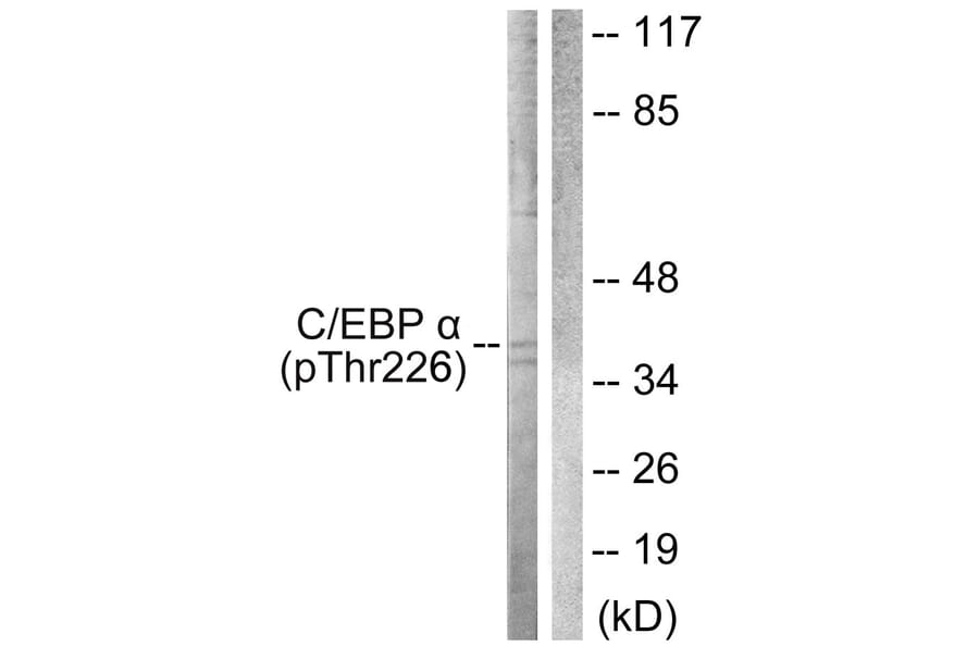 Western Blot - Anti-CEBP alpha (phospho Thr226) Antibody (A0825) - Antibodies.com