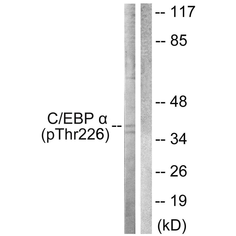 Western Blot - Anti-CEBP alpha (phospho Thr226) Antibody (A0825) - Antibodies.com