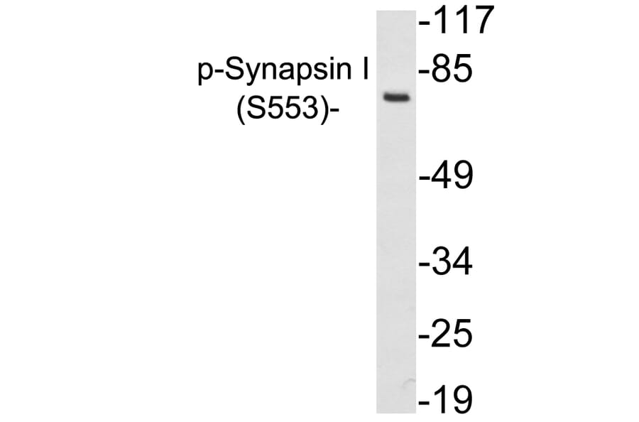 Western Blot - Anti-Synapsin I (phospho Ser553) Antibody (P12-1056) - Antibodies.com