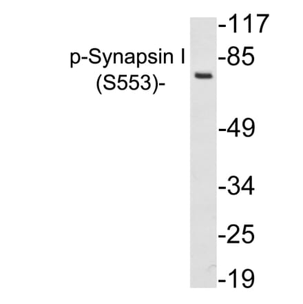Western Blot - Anti-Synapsin I (phospho Ser553) Antibody (P12-1056) - Antibodies.com