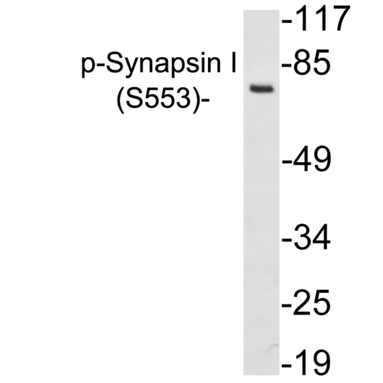Western Blot - Anti-Synapsin I (phospho Ser553) Antibody (P12-1056) - Antibodies.com