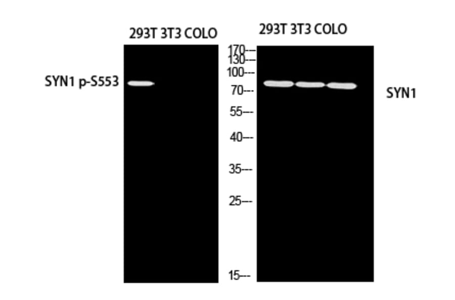 Western Blot - Anti-Synapsin I (phospho Ser553) Antibody (P12-1056) - Antibodies.com
