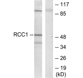 Western Blot - Anti-Retinoic Acid Receptor beta Antibody (C0315) - Antibodies.com