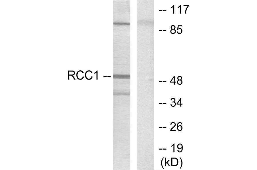 Western Blot - Anti-Retinoic Acid Receptor beta Antibody (C0315) - Antibodies.com