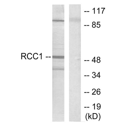 Western Blot - Anti-Retinoic Acid Receptor beta Antibody (C0315) - Antibodies.com